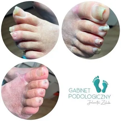 Gabinet Podologiczny Jolanta Zelek-Szczęch | Podolog Kraków